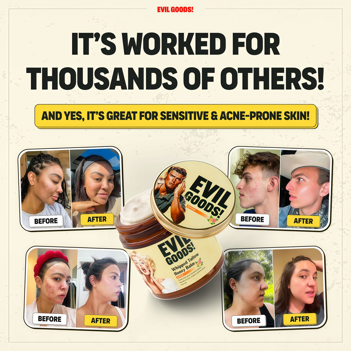 Whipped Beef Tallow and Manuka Honey Moisturizer for Skin, Face, Lips, Body - Unscented